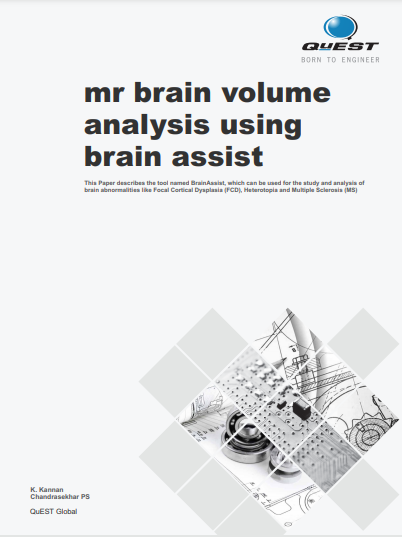 MR brain volume analysis using Brain Assist
